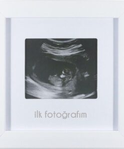 İlk Fotoğrafım Bebek Ultrason Çerçevesi - Bebek Odası Resim Anı Çerçevesi